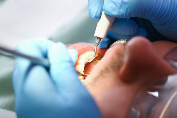 Best Emergency Broken Tooth Repair in Edburgh, IN