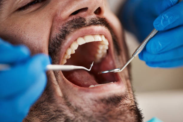 Best Emergency Treatment for Toothache in Edburgh, IN